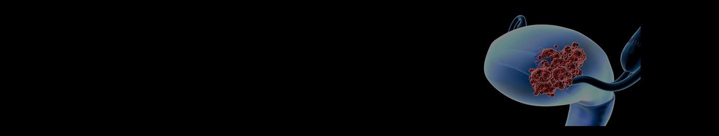 Gynecologic Cancer