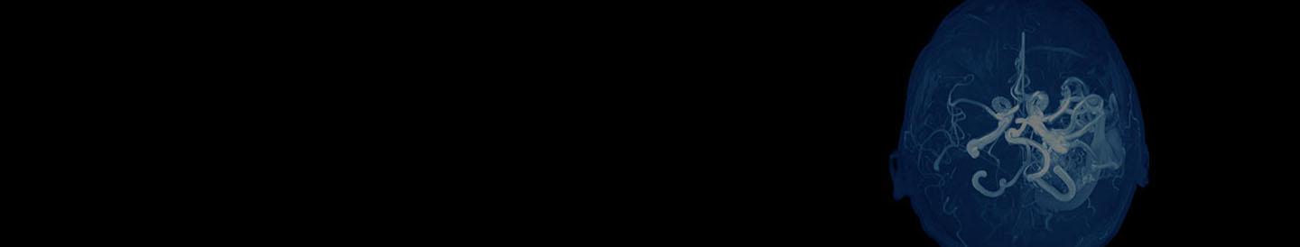 AVM